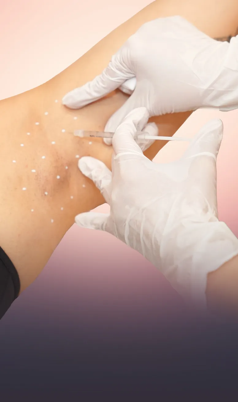 Hyperhidrosis Treatment (Underarms & Palms) treatment mobile banner at Toronto medical spa - Say Goodbye to Clammy Hands and Damp Shirts...